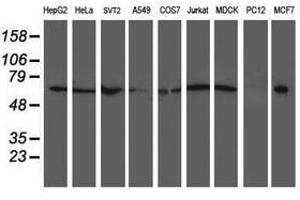 Image no. 4 for anti-X-Prolyl Aminopeptidase (Aminopeptidase P) 3, Putative (XPNPEP3) antibody (ABIN1501765)