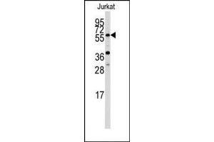 Image no. 1 for anti-Acetylcholinesterase (AChE) (N-Term) antibody (ABIN360209)