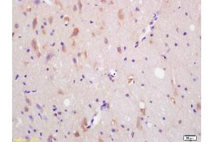 Formalin-fixed and paraffin embedded rat brain labeled with Anti-CXCR7/RDC1 Polyclonal Antibody, Unconjugated (ABIN1387536) at 1:200 followed by conjugation to the secondary antibody and DAB staining. (CXCR7 anticorps  (AA 151-250))