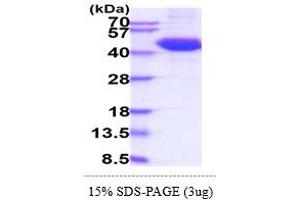 SDS-PAGE (SDS) image for T Cell Immunoreceptor with Ig and ITIM Domains (TIGIT) (AA 22-141) protein (hIgG-His-tag) (ABIN5855043)