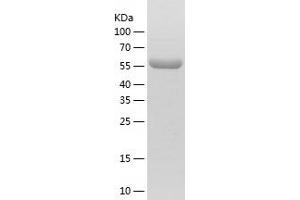 Western Blotting (WB) image for Heat Shock Factor Protein 1 (HSF1) (AA 2-529) protein (His tag) (ABIN7123274)