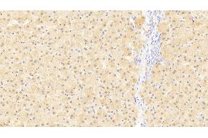 Detection of LMTK3 in Human Liver Tissue using Polyclonal Antibody to Lemur Tyrosine Kinase 3 (LMTK3)