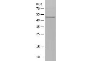 Western Blotting (WB) image for Hyperpolarization Activated Cyclic Nucleotide-Gated Potassium Channel 4 (HCN4) (AA 931-1203) protein (His-IF2DI Tag) (ABIN7123394)