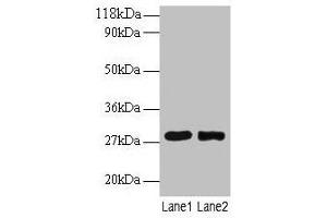 Western blot All lanes: MPZ antibody at 2 μg/mL Lane 1: 293T whole cell lysate Lane 2: EC109 whole cell lysate Secondary Goat polyclonal to rabbit IgG at 1/15000 dilution Predicted band size: 28, 35 kDa Observed band size: 28 kDa
