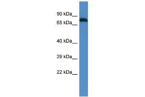 Host: Rabbit Target Name: EPN1 Sample Type: PANC1 Whole Cell lysates Antibody Dilution: 1. (Epsin 1 anticorps  (C-Term))