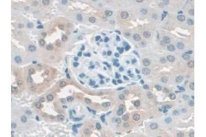 DAB staining on IHC-P; Samples: Mouse Kidney Tissue (SCAF11 anticorps  (AA 969-1165))