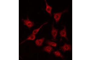 ABIN6272244 staining HeLa by IF/ICC. (ARHGAP1 anticorps  (Internal Region))