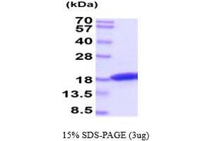 SDS-PAGE (SDS) image for Interferon gamma (IFNG) (AA 24-167) protein (His tag) (ABIN5854788)