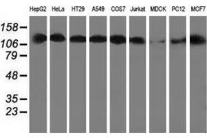 Western blot analysis of extracts (35 µg) from 9 different cell lines by using anti-HDAC6 monoclonal antibody. (HDAC6 anticorps)