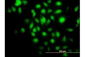 Immunofluorescence of monoclonal antibody to BAG1 on HeLa cell.