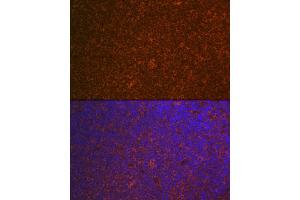 Immunofluorescence analysis of mouse spleen using C Rabbit mAb (ABIN7266125) at dilution of 1:100 (40x lens).