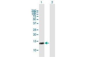 Western Blot analysis of RAB28 expression in transfected 293T cell line by RAB28 MaxPab polyclonal antibody. (RAB28 anticorps  (AA 1-95))