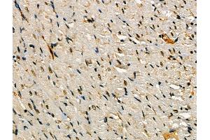 Phospho-SNAIL (Ser11) Antibody at 1/100 staining Rat heart tissue by IHC-P. (SNAIL anticorps  (pSer11))