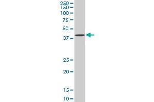 BAG1 monoclonal antibody (M02), clone 2D3.