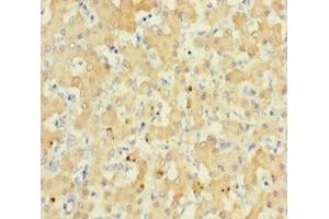 Immunohistochemistry of paraffin-embedded human liver tissue using ABIN7167868 at dilution of 1:100 (RS1 anticorps  (AA 24-224))