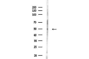 anti-Retinoic Acid Receptor, gamma (RARG) (N-Term) antibody