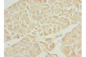 IHC analysis of paraffin-embedded human heart tissue using TNNI3K antibody (1/100 dilution). (TNNI3K anticorps  (AA 1-75))