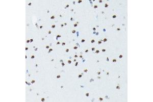 Immunohistochemistry of paraffin-embedded rat brain using Phospho-p70 S6 Kinase 1-T421/S424 antibody (ABIN6135340, ABIN6136296, ABIN6136297 and ABIN7101878) at dilution of 1:100 (40x lens).