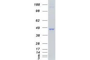 Validation with Western Blot