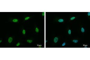 ICC/IF Image NRF1 antibody detects NRF1 protein at nucleus by immunofluorescent analysis. (NRF1 anticorps)