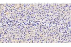 Detection of PRDX4 in Human Liver Tissue using Polyclonal Antibody to Peroxiredoxin 4 (PRDX4)