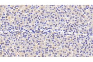 Detection of PRDX4 in Human Liver Tissue using Polyclonal Antibody to Peroxiredoxin 4 (PRDX4) (Peroxiredoxin 4 anticorps  (AA 6-249))