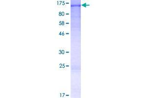 Image no. 1 for IQ Motif and Sec7 Domain 1 (IQSEC1) (AA 1-814) protein (GST tag) (ABIN1308050)