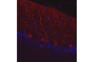 Indirect immunostaining of paraffin embedded mouse cerebellum section (dilution 1 : 200; red). (CALB1 anticorps)