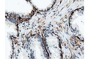 Image no. 6 for anti-5'-Nucleotidase Domain Containing 1 (NT5DC1) antibody (ABIN1499837)