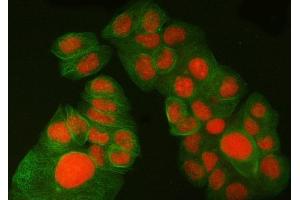 IF analysis of SA1/STAG1 using anti-SA1/STAG1 antibody (ABIN7602412) and anti-Tubulin Alpha antibody (ABIN7600339).