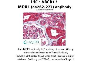 Image no. 1 for anti-ATP-Binding Cassette, Sub-Family B (MDR/TAP), Member 1 (ABCB1) (AA 262-277) antibody (ABIN1731403)