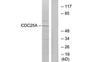 Western blot analysis of extracts from A2780 cells, treated with UV, using CDC25A (Ab-75) Antibody. (CDC25A anticorps  (AA 43-92))