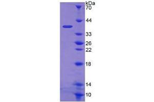 Image no. 1 for Fructosamine 3 Kinase (FN3K) (AA 1-309) protein (His tag) (ABIN6237238)