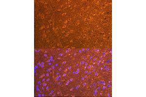 Immunofluorescence analysis of mouse brain cells using PSD93/chapsyn-110/DLG2 Rabbit mAb (ABIN7266793) at dilution of 1:100 (40x lens). (DLG2 anticorps)