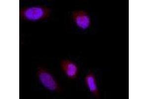 Immunofluorescence (IF) image for anti-Glutamate-Rich WD Repeat Containing 1 (GRWD1) (full length) antibody (ABIN2451991)