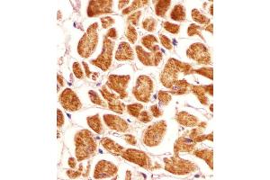 Antibody staining PCCA in human heart tissue sections by Immunohistochemistry (IHC-P - paraformaldehyde-fixed, paraffin-embedded sections). (PCCA anticorps  (AA 362-390))