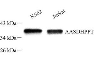 Western blot analysis of AASD-PPT (ABIN7073034) at dilution of 1: 500 (AASDHPPT anticorps)