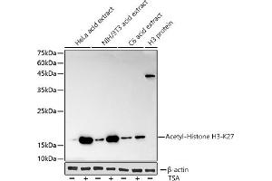 Western blot analysis of extracts of various cell lines, using Acetyl-Histone H3-K27 antibody (ABIN3016650, ABIN3016651, ABIN3016652, ABIN1682513 and ABIN1682514) at 1:1000 dilution.