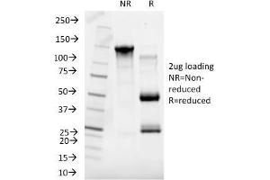 SDS-PAGE Analysis Purified SHBG Mouse Monoclonal Antibody (SHBG/245). (SHBG anticorps)