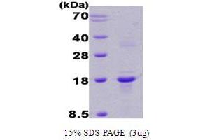SDS-PAGE (SDS) image for Regulator of Calcineurin 1 (RCAN1) (AA 1-117) protein (ABIN667702)