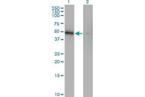 Western Blot analysis of ZNF24 expression in transfected 293T cell line by ZNF24 monoclonal antibody (M03), clone 4C2. (ZNF24 anticorps  (AA 1-368))