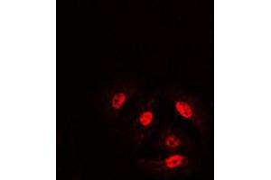 Immunofluorescent analysis of Cofilin (pS3) staining in HeLa cells.