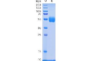 Human NKp30 Protein, hFc Tag on SDS-PAGE under reducing condition.