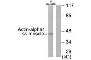 Western blot analysis of extracts from rat muscle cells, using Actin-alpha-1 Antibody. (Actin anticorps  (AA 1-50))