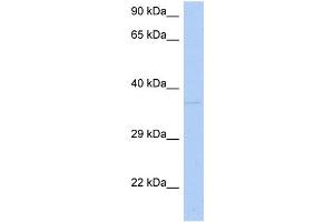 WB Suggested Anti-DRG1 Antibody Titration:  0. (DRG1 anticorps  (N-Term))