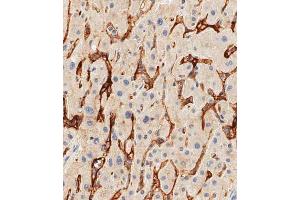 Immunohistochemical analysis of paraffin-embedded human liver tissue using A performed on the Leica® BOND RXm.