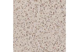 IHC analysis of U1A/SNRPA using anti-U1A/SNRPA antibody (ABIN7600891). (SNRPA1 anticorps  (AA 25-218))