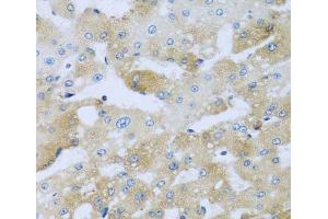 Immunohistochemistry of paraffin-embedded Human liver damage using AP1M2 Polyclonal Antibody at dilution of 1:100 (40x lens).