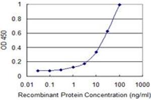 Detection limit for recombinant GST tagged L1CAM is 0.