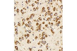 Immunohistochemistry analysis of paraffin embedded rat brain using Neurotensin (ABIN7074827) at dilution of 1: 500